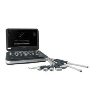 Portable ultrasound